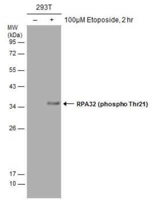 Western Blot: RPA2 [p Thr21] Antibody [NBP3-12924]